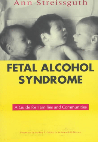 fetal alcohol syndrome